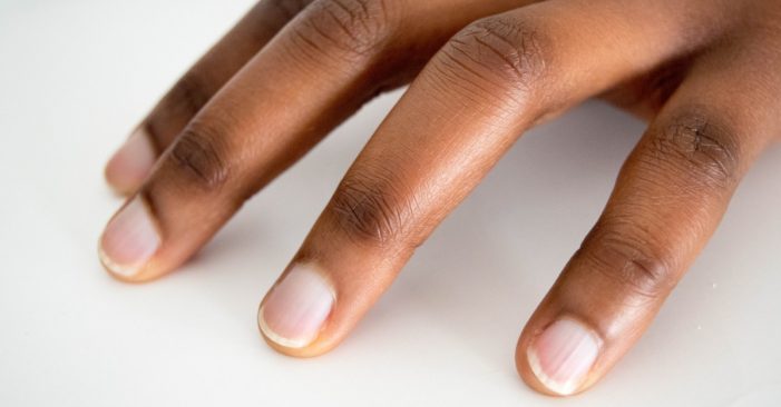 What Are ‘COVID Nails’—And Are They a Sign You’ve Had the Virus? Here’s What Doctors Say