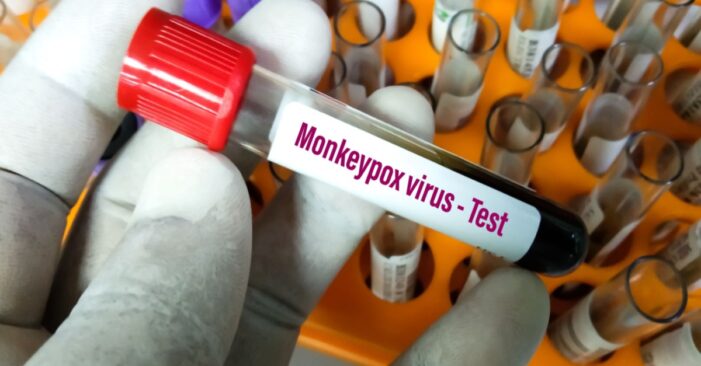 Is Monkeypox a Pandemic? An Epidemiologist Explains Why it Isn’t Likely to Become as Widespread as COVID-19, but is Worth Watching