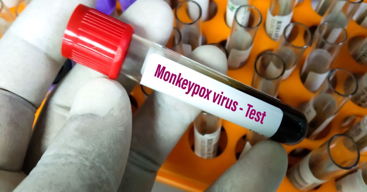 Blood sample tube for Monkeypox virus test-img