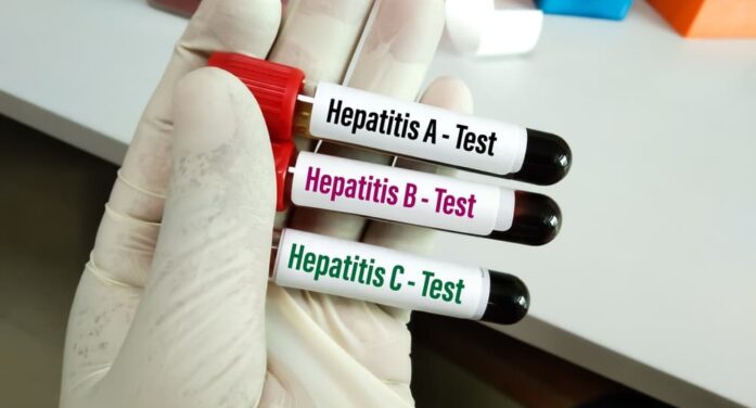 WHO Sounds Alarm on Viral Hepatitis Infections Claiming 3500 Lives Each Day